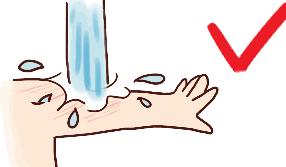 健康丨超实用的急救方法，建议每个人收藏