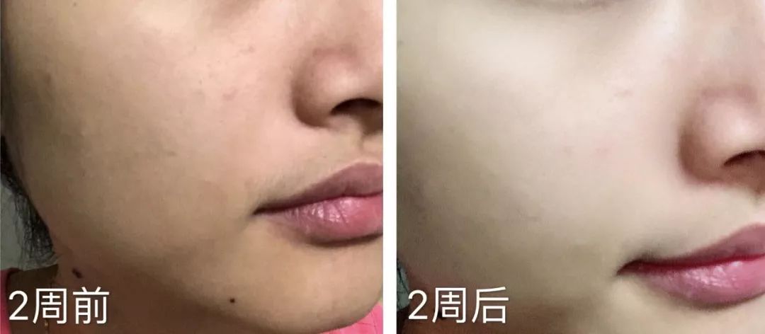 日本纯原神仙水,日本神仙水和韩国神仙水