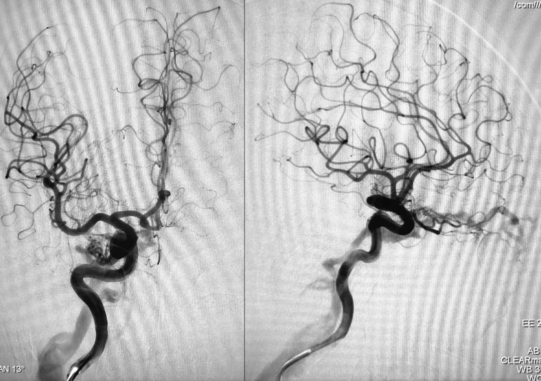 柳暗花明第二集,柳暗花明52集完整版下载
