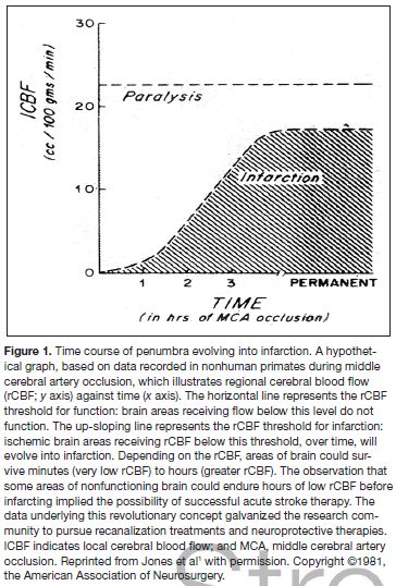 缺血性脑卒中静脉溶栓专家共识,急性缺血性卒中溶栓治疗临床需求