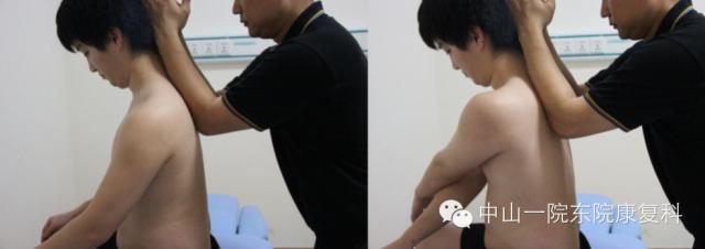 康复治疗技术人体解剖学,12条筋膜链解析及治疗手法