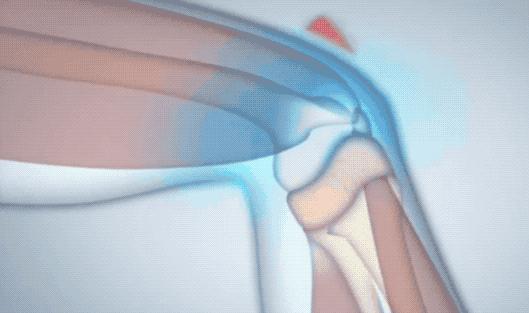 腰酸背痛、肩颈酸乏、肌肉疲劳？德国人有个家喻户晓的妙招