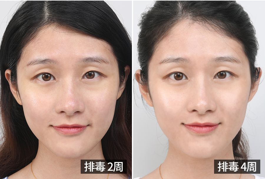 39岁宋慧乔完美复出御姐范十足,37岁宋慧乔重拾颜值巅峰