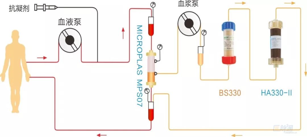 自免肝甲亢,自免肝是不是甲亢引起的