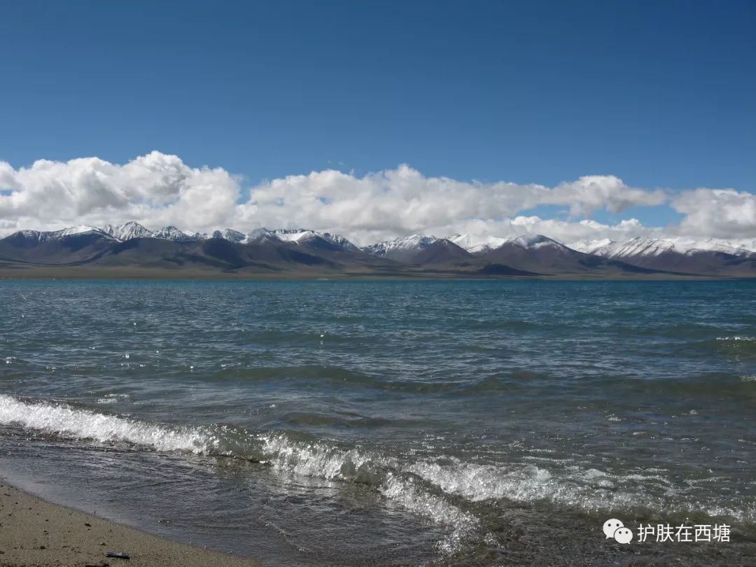 水过敏会引起荨麻疹吗,水过敏皮肤