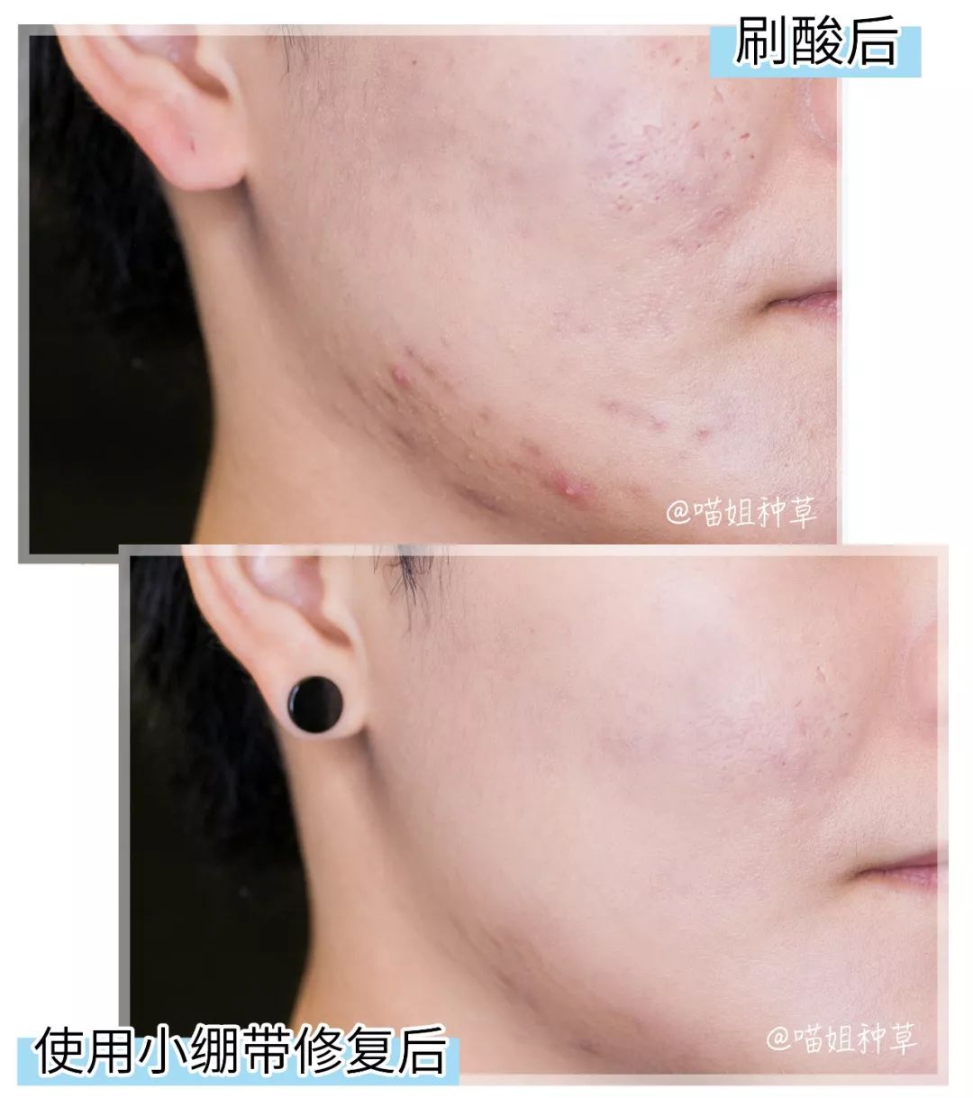 皮肤科医生护肤简单,皮肤科医生各种药膏的护肤作用