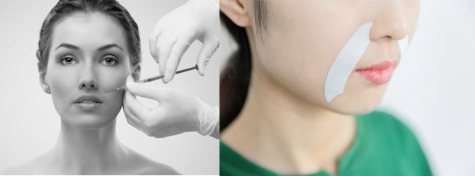 眉间纹和法令纹除皱针能去掉吗,嘴角纹法令纹抬头纹国货推荐