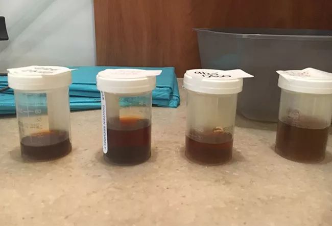 尿液各种颜色都代表什么病,尿液是五颜六色的怎么回事