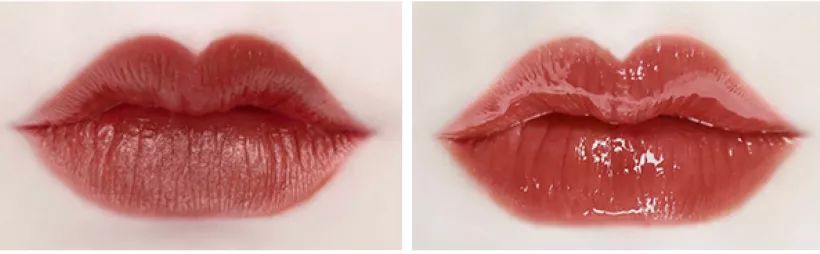 薄唇如何丰唇好看,丰唇使嘴唇变得更美