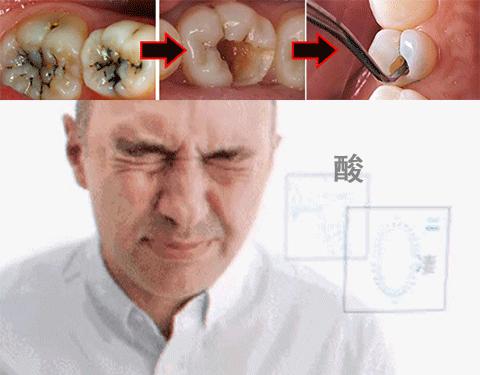 牙龈上火牙周护理牙膏,牙龈上火牙膏