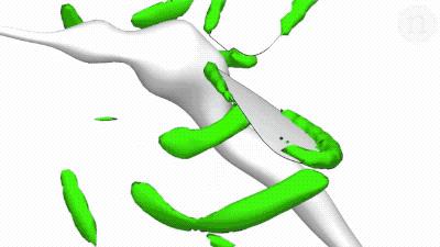 蚊子不会咬人吗,超级讨厌蚊子如何把蚊子赶尽杀绝
