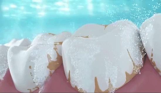 牙龈肿了出血口臭牙黄用什么牙膏,牙龈上火牙膏