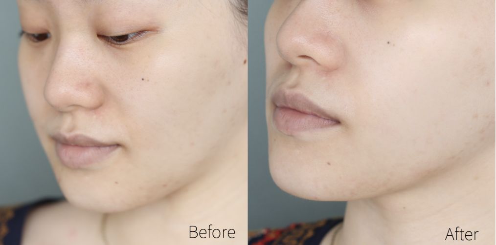 drjart蒂佳婷新包装面膜辨别真假,drjart蒂佳婷紫色面膜使用方法