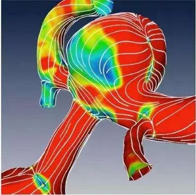 我是医生，假如我得了颅内动脉瘤，我会怎么办？