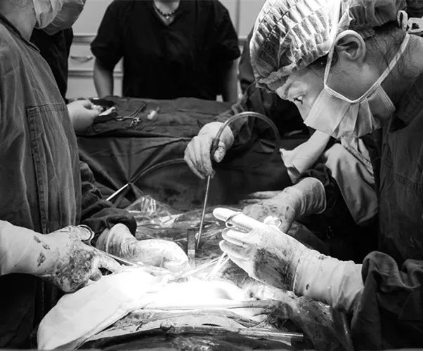 42岁大妈肚子突出如5月身孕，巨大瘤子在子宫内扭转