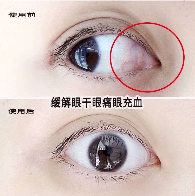 适合熬夜的护眼神器,眼睛疲劳用什么护眼神器