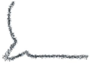 早孕孕酮越来越低怎么办,早孕孕酮低是宫外孕吗