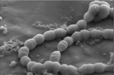 为什么喝乳酸菌奶能改善肠道,酸奶和乳酸菌是一回事吗