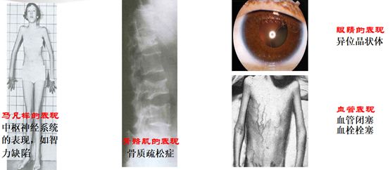 健康新指标,健康指标有哪些
