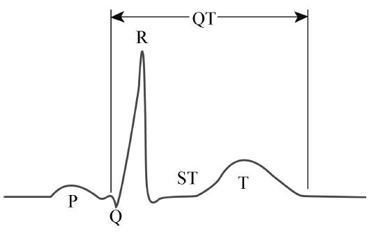 长qt间期综合征是心脏哪里的问题,短qt间期综合征心电图图片