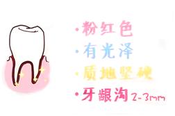 20岁牙周炎牙齿掉光了 (牙齿都掉光了牙周炎是不是就好了)