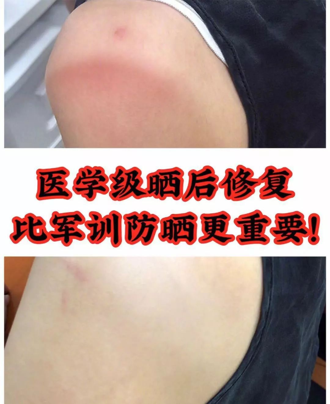 这款急救弹性蛋白贴，每天一片赶走干纹，还你天鹅美颈