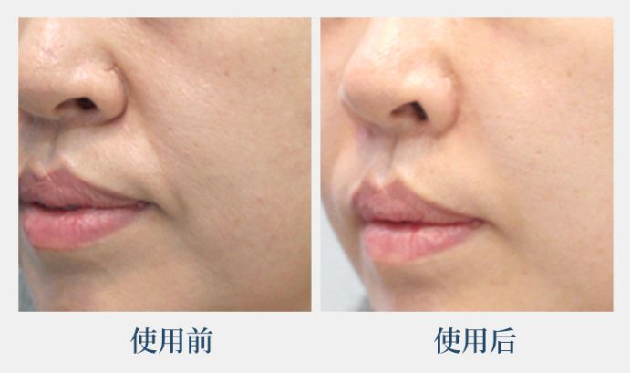 44岁的她竟睡服半个娱乐圈,被亿万直男跪舔!遭小S妒忌十年:凭什么?