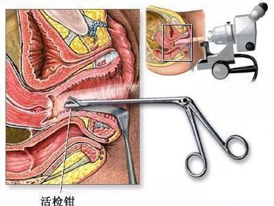 妇产科腔镜科普,妇产超声科普视频讲解