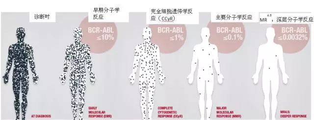 从白血病到瘫痪,从白血病到重大疾病险