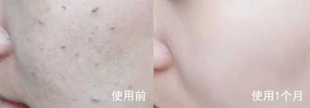 日本去角质磨砂膏,日本去角质脸部清洁第一名