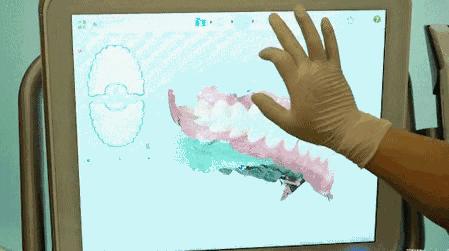 武汉种植牙齿多少钱一个,湖北种植牙补贴政策是真的吗