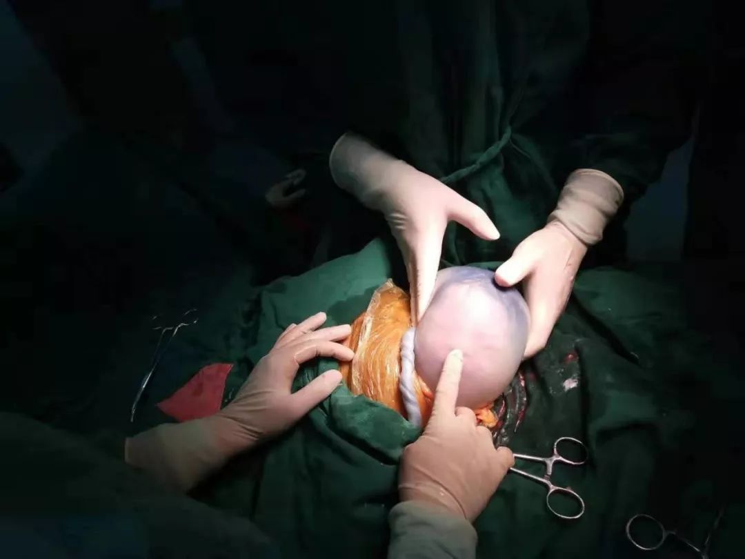 36周产下男婴肚子里还有哪吒,哪吒动画母亲怀孕片段