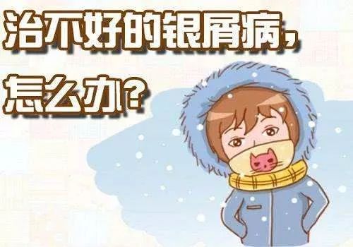 武汉协和医院皮肤科银屑病专家,治疗牛皮癣银屑病有什么特效方法