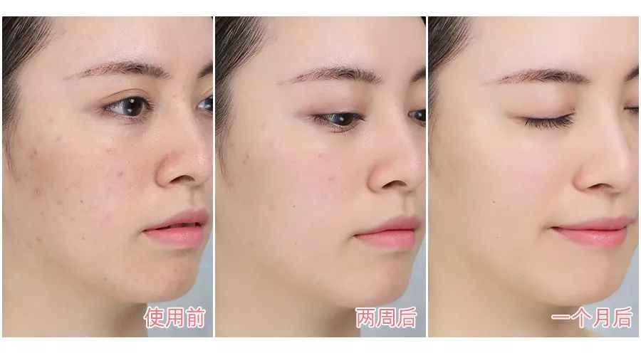 “韩国第一美魔女”私照曝光！51岁凭初恋脸狂吸680万人围观：原来男神都喜欢这样的？