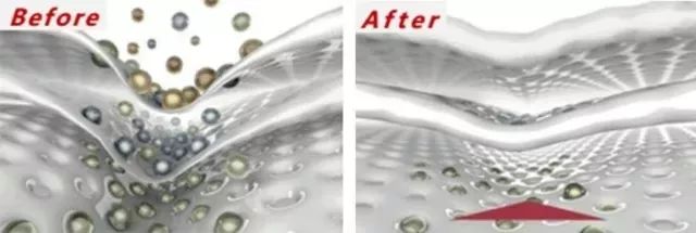 法令纹眼纹一个都逃不掉,法令纹和眼纹怎么才能有效改善