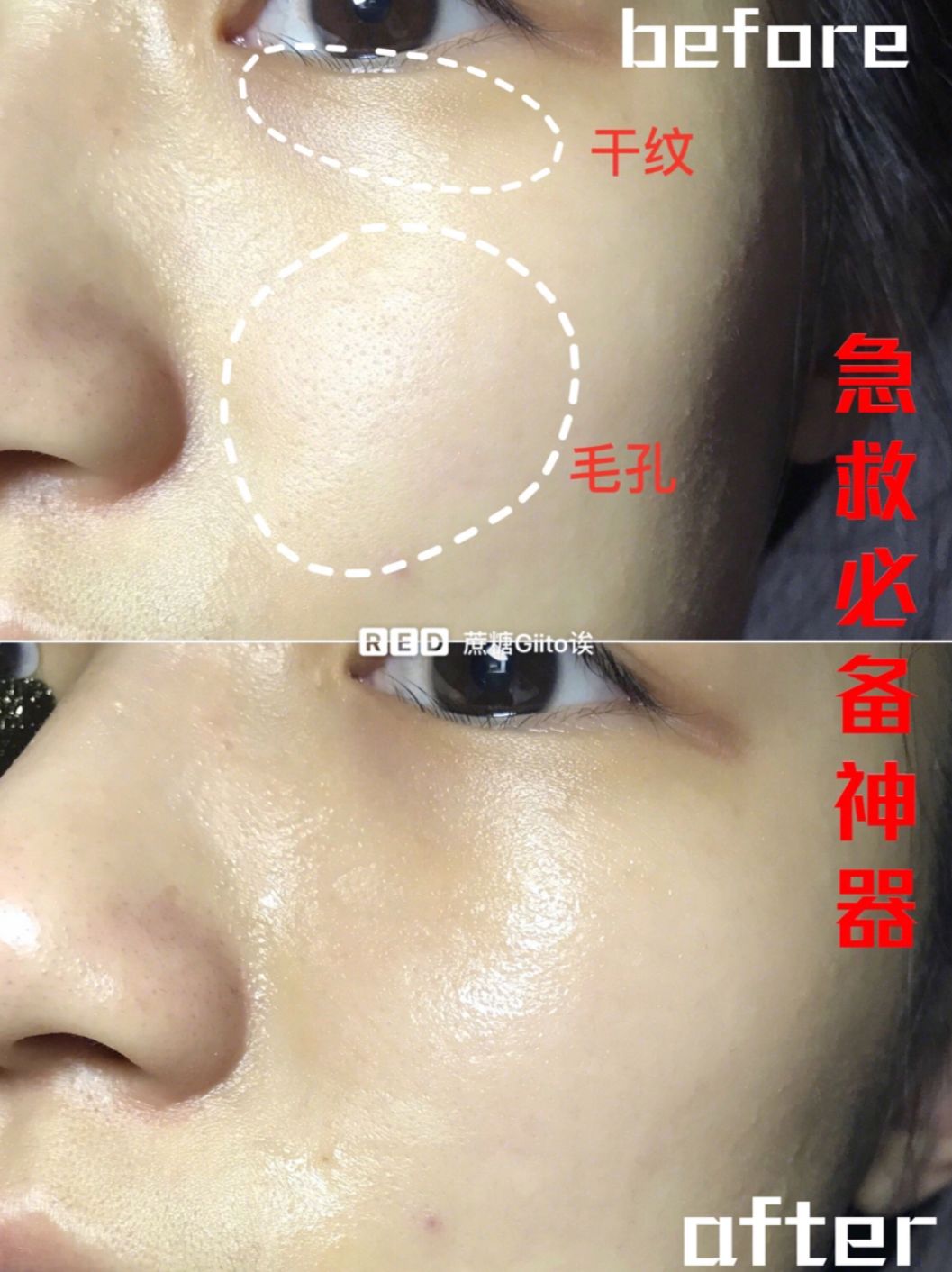 眼膜贴八小时紧致抗皱淡细纹,官方眼膜紧致抗皱淡细纹法令纹