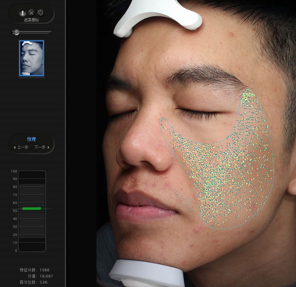 五周年福利｜皮肤“照妖镜”VISIA免费体验！定制你的皮肤管理方案，浙大四院五周年福利持续放送中