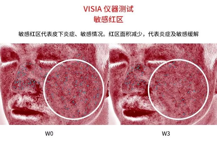 同样的年龄有的年轻人有的人老,同样的年龄为何他却比你显得年轻