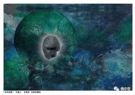 【贴心】旅居海外80载,传奇艺术家脑梗收治佛中医,大赞祖国医疗服务