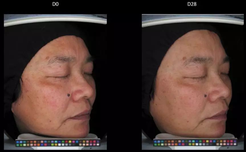 变白的视频教程,真正变白小技巧