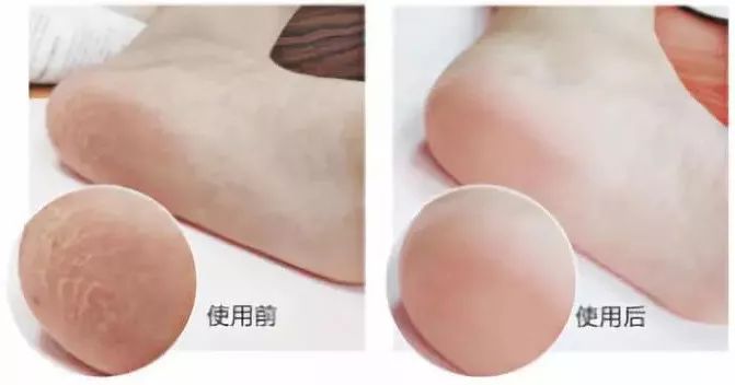 足部护理保湿防干裂去死皮,干燥足部保湿霜