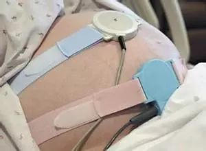 龙田金秋保胎十天,龙田金秋剖腹产