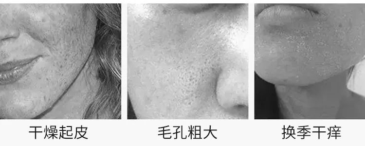 秋冬超级爆款面霜医用,秋冬面霜保湿滋润成人用推荐国货