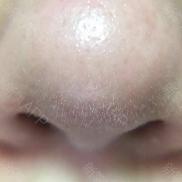 1元体验“爱马仕”级的变美服务，限量100份，再不抢就没了