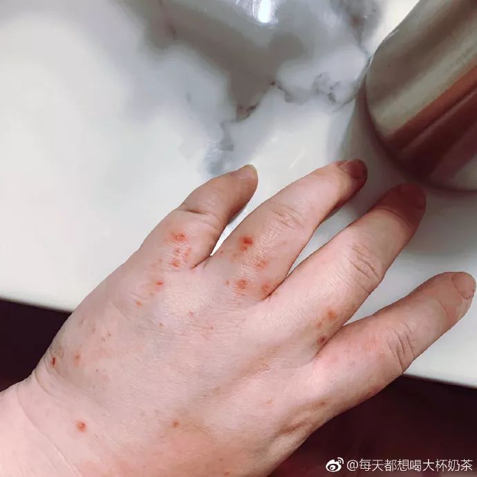 32岁的二胎妈妈死因,32岁妈妈猝死真相被曝光