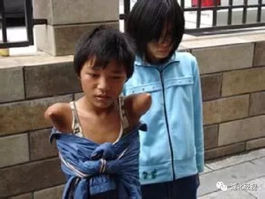 眼球被挖了还会活着吗,眼球被挖了之后眼皮还能睁开吗