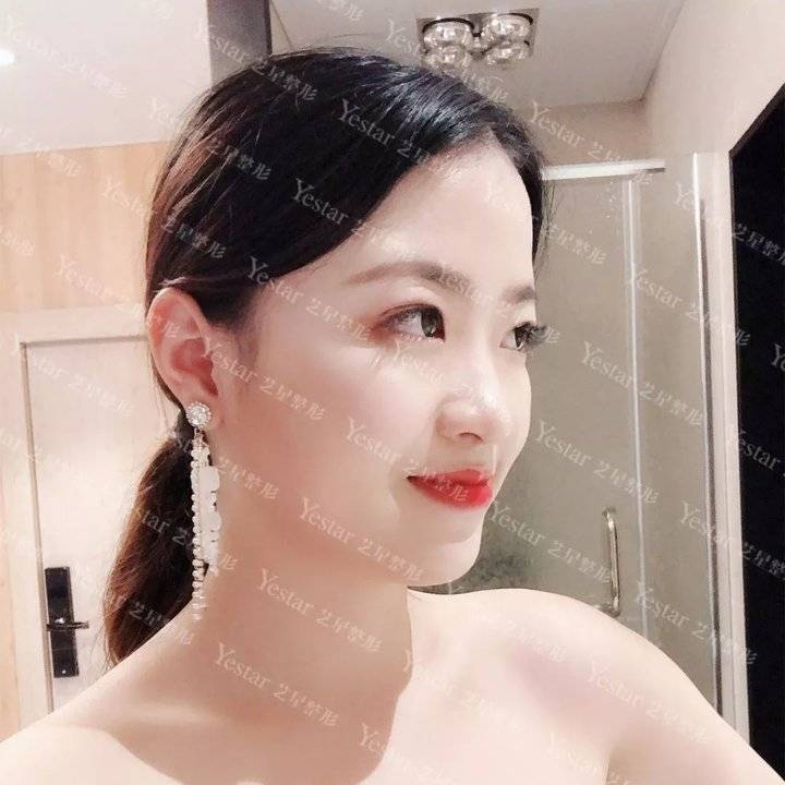 十大骗局肉毒素药,微整形注射假药案例