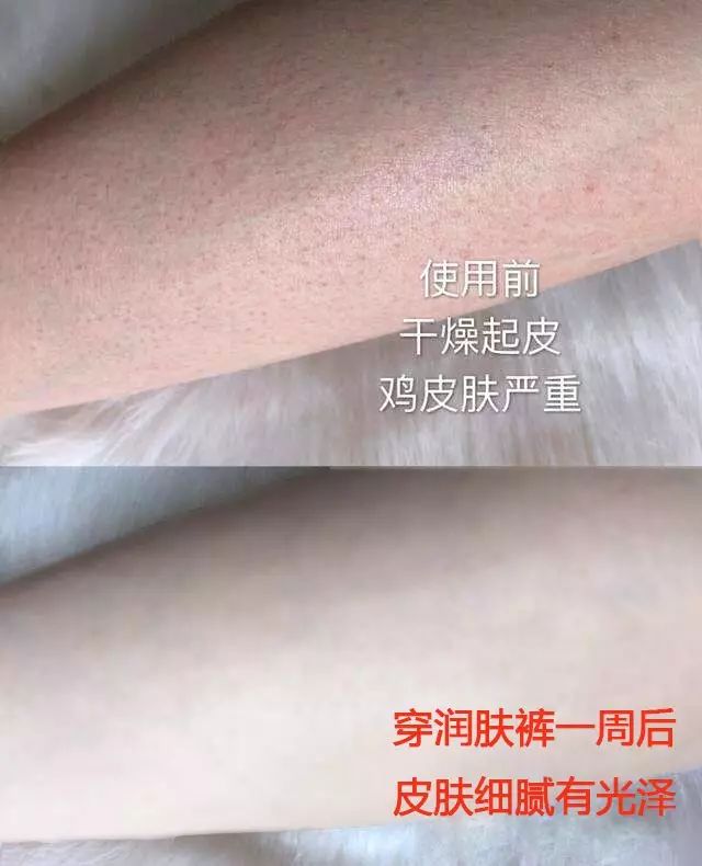 把护肤品穿在腿上是种什么体验？还能「显瘦10斤+超级保暖」