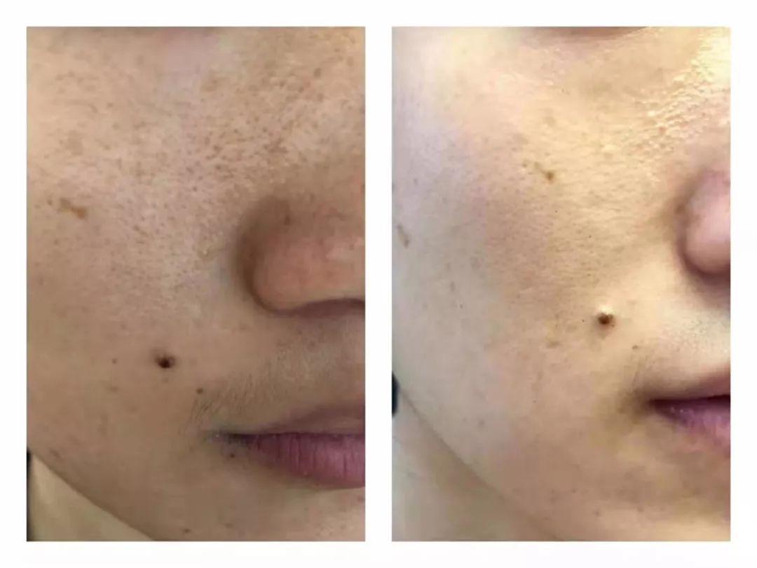 睡前做的20件事,睡前必备变美小妙招