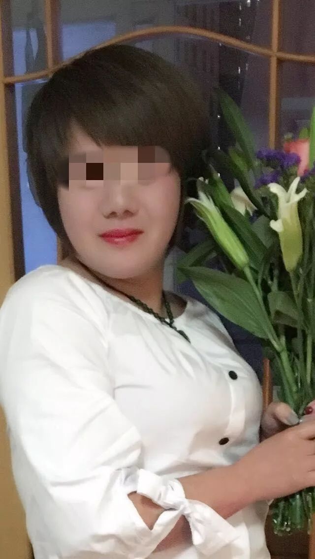 女子隆鼻失败变成三角鼻,南京女子鼻子整形4次
